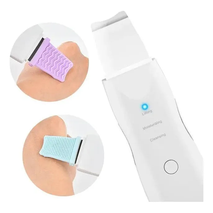 Dispositivo De Peeling Facial Antiarrugas Ultrasónico Para Acné Y Puntos Negros