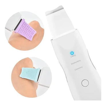 Dispositivo De Peeling Facial Antiarrugas Ultrasónico Para Acné Y Puntos Negros