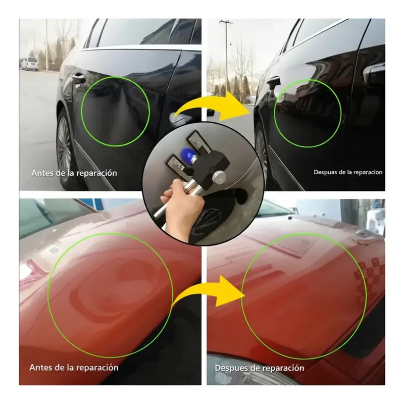Kit Sacabollos Con Ventosas 18 Piezas Reparación Auto